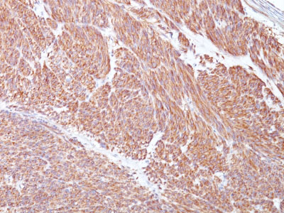 IHC -  CD117 / c-Kit (Marker for Gastrointestinal Stromal Tumors) Antibody - With BSA and Azide AH11624-20